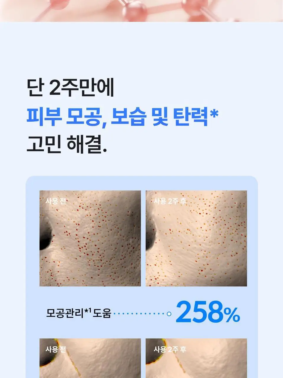 [모공 기미 탄력 뷰티디바이스] 반코르 리리힐 고주파 마사지기 (+기미&잡티케어 세럼 증정) 상세페이지 14